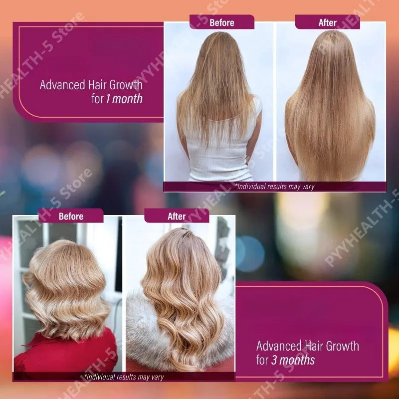 Vitamines et compléments pour la pousse des cheveux pour femmes | Biotine 10000mcg, collagène, soutien peau et ongles 120 gélules pour 60 jours